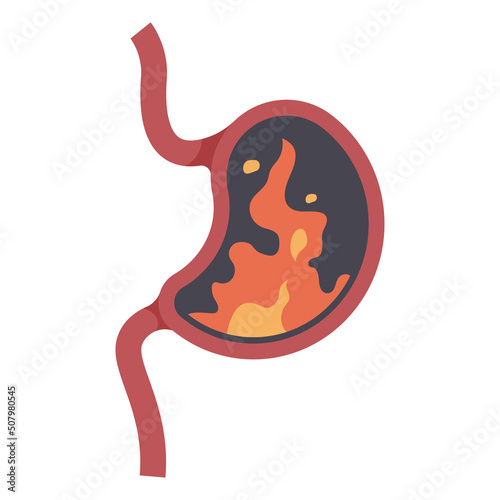 Heartburn vector cartoon illustration isolated on a white background.