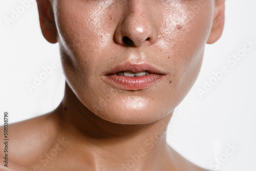 close-up girl with sweaty skin on her face and excessive oily sheen, excessive sweating, hyperhidrosis disease photo