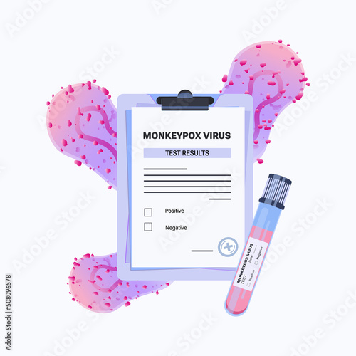 Monkeypox virus vector illustration purple clipboard with results of test. Blood sample tube for Monkeypox virus test. Monkeypox virus zoonotic viral disease 