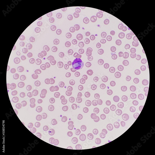 Detection of intracellular Hepatozoon canis gamonts in neutrophils and monocytes in stained blood smears. Hepatozoon canis within canine leukocyte under a microscope.