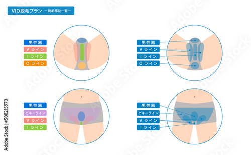 男性 脱毛箇所一覧 VIO脱毛 ハイジニーナ