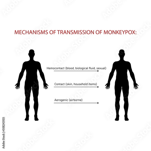 Mechanisms and ways of transmission of monkeypox.Monkeypox virus zoonotic viral disease that can infect human, nonhuman primates. Monkey pox. Vector illustration