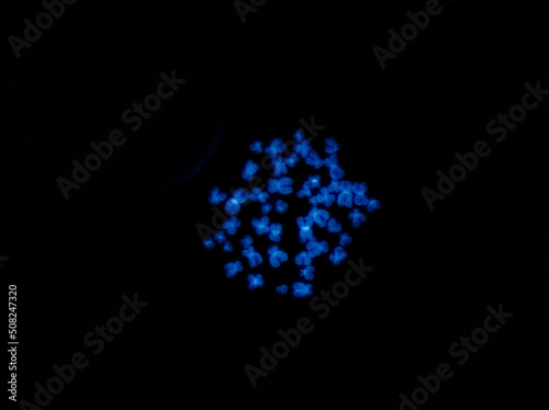 Chromosomes under fluorescence microscope  fluorescence in situ hybridization technique  Human chromosomes from blood