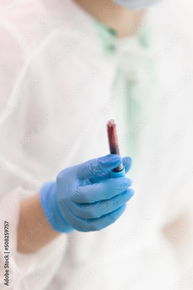 the nurse shakes the test tube with blood to conduct a qualitative analysis of the patient's blood, turns the test tube with the lid down