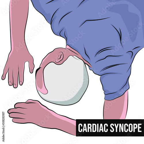 Vasovagal syncope occurs when you faint because the body overreacts to certain triggers.