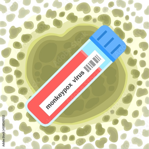 Blood from monkeypox infection in vector