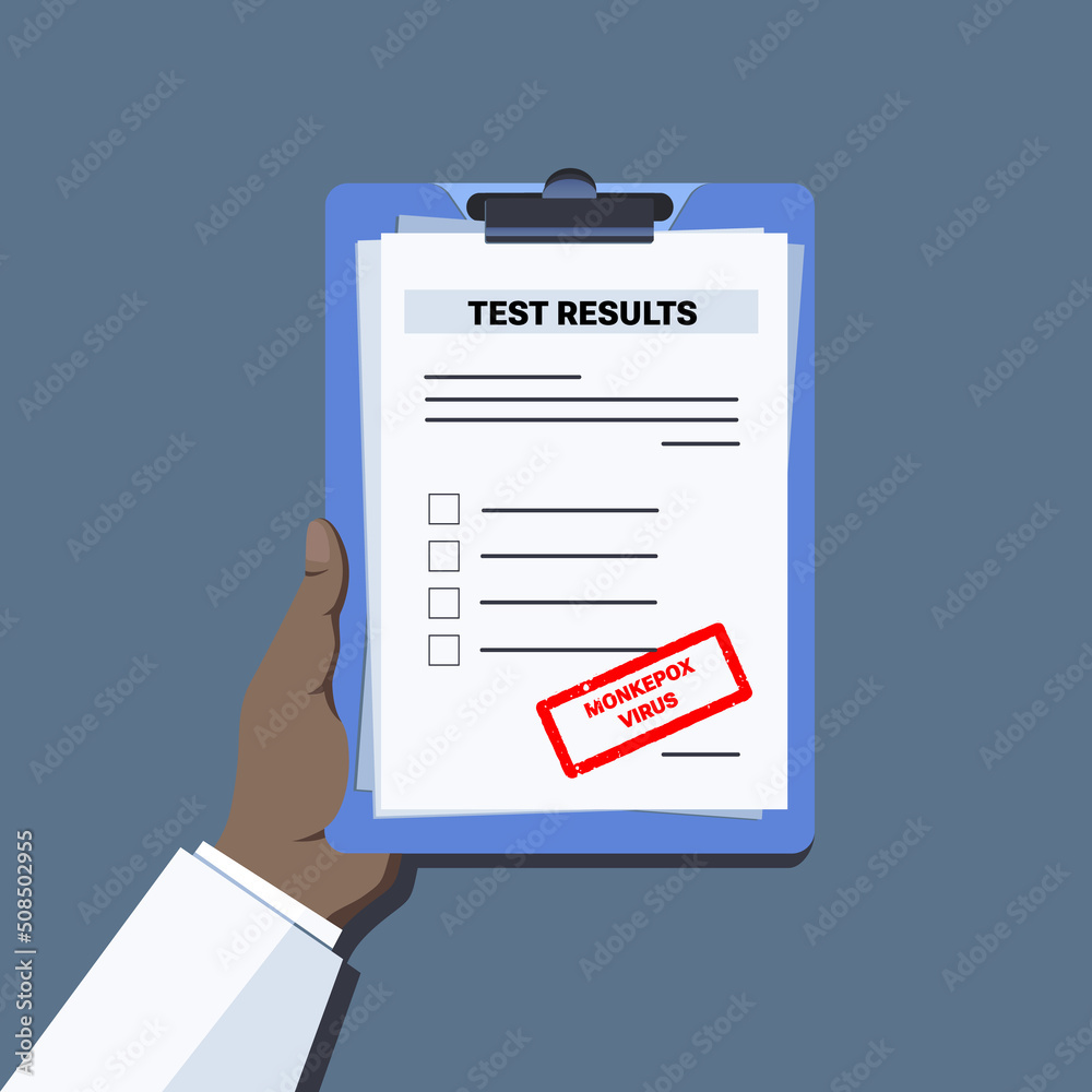 Vector illustration. Doctor agent or medical officer hand holding clipboard with Monkeypox virus test results. Monkeypox virus zoonotic viral disease
Vector illustration. Doctor agent or medical officer hand holding clipboard with Monkeypox virus test results. Monkeypox virus zoonotic viral disease