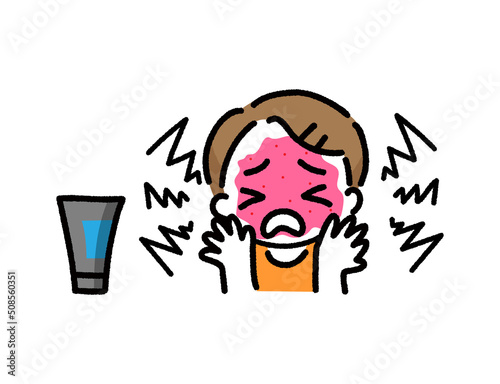 除毛剤　脱毛剤　顔　腫れる　発疹