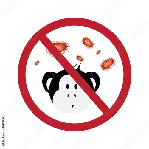 Monkeypox stop sign. Monkeypox infection pandemic. Virus  epidemic  disease. 