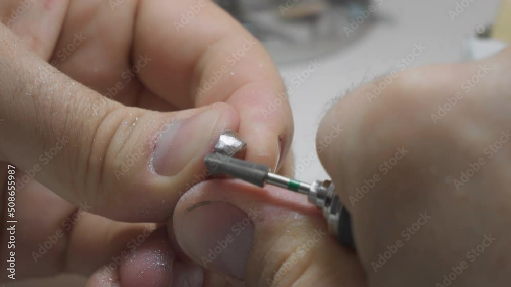 Worker is Polishing a small metal crown at the dental clinic. Dental