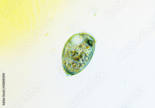 Ciliates Stentor found in freshwater pond under the light microscope photo
