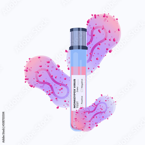 Monkeypox virus (MPXV) vector illustration Blood sample tube for Monkeypox virus test. Monkeypox virus zoonotic viral disease 