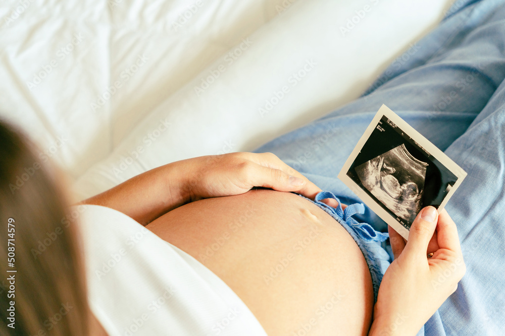 Ultrasound image pregnant baby photo. Woman holding ultrasound pregnancy picture. Pregnancy, medicine, pharmaceutics, health care and people concept. Ultrasound image pregnant baby photo. Woman holding ultrasound pregnancy picture. Pregnancy, medicine, pharmaceutics, health care and people concept.