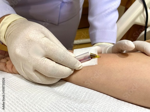 A nurse is collecting a blood sample  using a needle to draw a vein to take a blood sample from a patient.