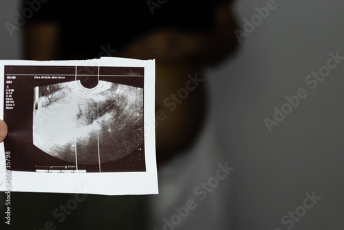 pregnant women sonogram with blurred background from flat angle photo