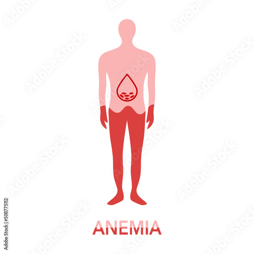 Anemia concept vector illustration. Low red blood cells in human body in flat design on white background.