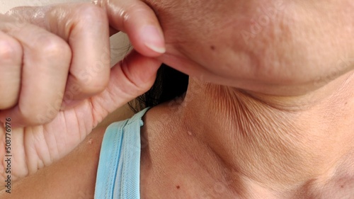 Foto close up portrait showing the fingers squeezing her flabbiness adipose hanging skin under the neck, problem wrinkle and flabby skin under the chin of the patient woman, concept health care