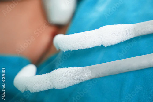Selective focus on ice frost from cryoablation, medical technique for freezing the tumor to make the tumor cell death.
