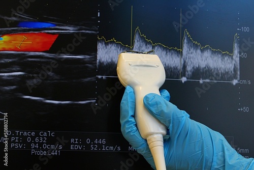Modern linear ultrasound diagnostic probe held in left hand in blue sterile glove with conductive gel on scanning part, carotic extracranial doppler exam and blood flow curves in background. photo