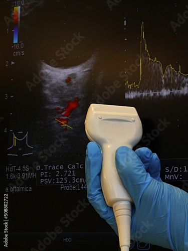 Modern linear ultrasound diagnostic probe held in doctor left hand in blue glove with doppler ocular ultrasound scan and flow curves in background. Used in neuro-ophtalmology.