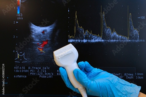 Modern linear ultrasound diagnostic probe held in doctor hand in blue glove with doppler ocular ultrasound scan and flow curves in background. Used in neuro-ophtalmology.