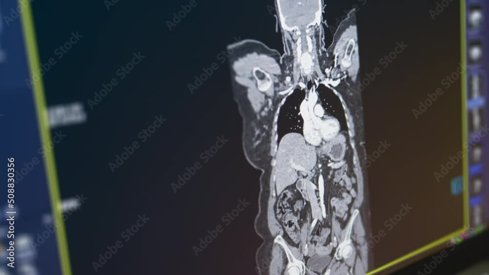 MRI of the brain in sagittal plane with contrast media. magnetic ...