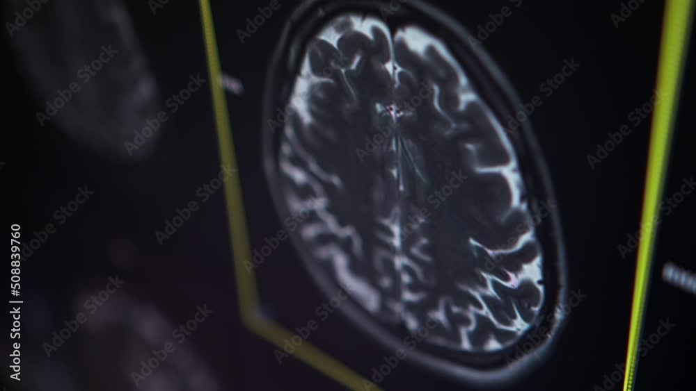 Medicine. MRI of the brain in sagittal plane with contrast media ...
