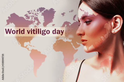 Woman with vitiligo on world map. International and World Vitiligo Day.