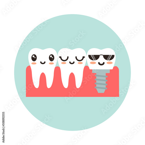Healthy teeth and a tooth with an implant. Flat vector illustration.