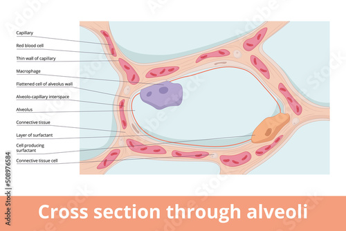 Alveoli in cross-section showing basic structural entities: cappilaries, macrophage, alveolus and cell producting surfactant.  photo