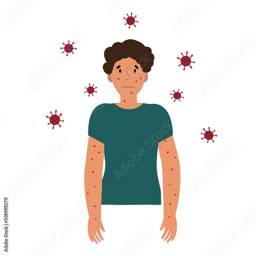 Flat vector illustration of man in t-shirt with blisters on skin caused by ingestion of monkeypox virus isolated on white background