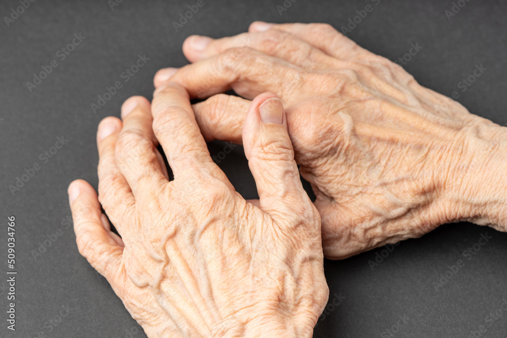 Old wrinkled hands folded together on a table.