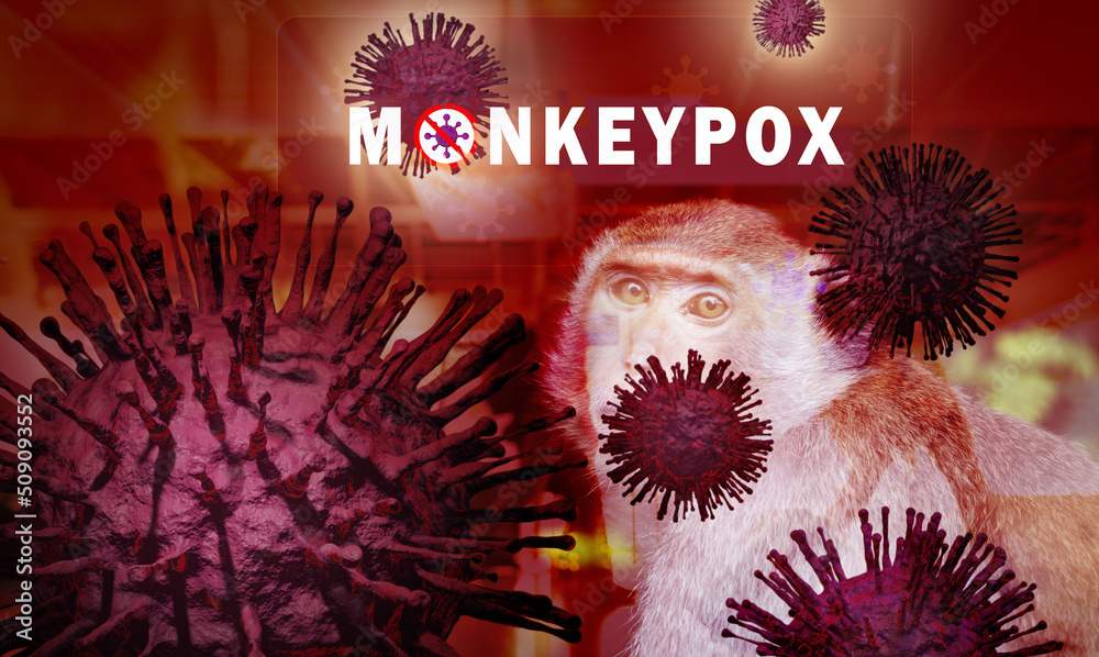 Stockfoto Monkeypox outbreak concept. Monkeypox is caused by monkeypox