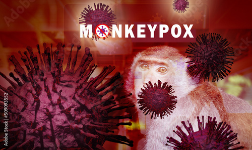 Monkeypox outbreak concept. Monkeypox is caused by monkeypox virus. Monkeypox is a viral zoonotic disease. Virus transmitted to humans from animals. Monkeys may harbor the virus and infect people. photo