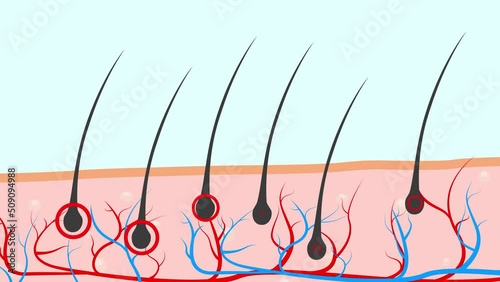 2D animation of hair loss proceeded by nutrient deficiency