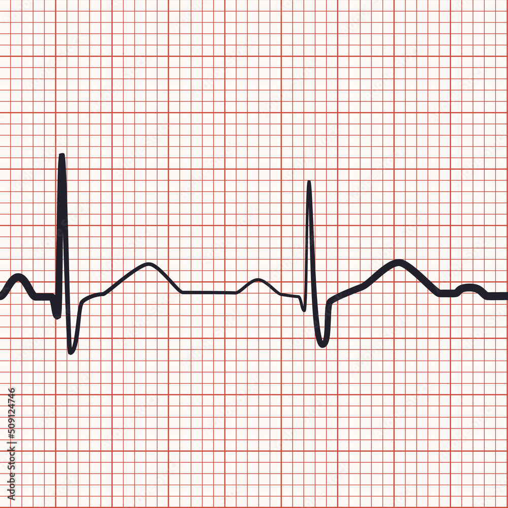Electrocardiogram seamless background. Heart beat rate recording on