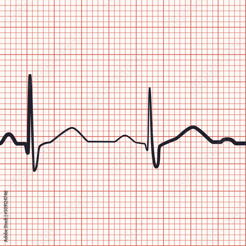 Electrocardiogram seamless background. Heart beat rate recording on pink ekg paper. Millimeter graph and curve of cardiology rhythm. Medical vector design for hospital page, banner