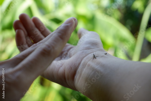 Aedes mosquito bites on a woman's arm. 
