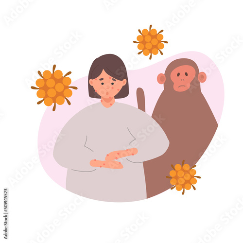 Rash on female hands and face. Monkey pox symptoms. World epidemic outbreak. Disease spread awareness. Vector illustration in flat style.