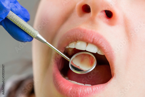Cuadro en lienzo Taking care of teeth