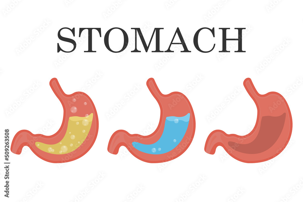 Healthy and unhealthy, empty and full human stomach, gastric juice
