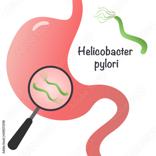 Vector Illustration Graphic of Cartoon Helicobacter Pylori