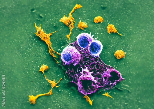Cancer Cells SEM image dividing cancer cells over healthy tissue with immune cells T-Cells virus engineered for destroying abnormal modified cells attacking