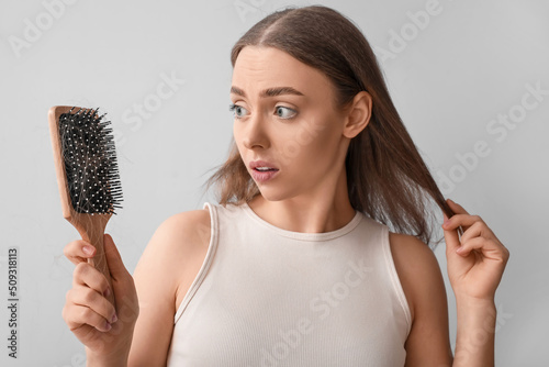 Young woman with hair loss ...