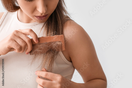 Young woman with hair loss ...