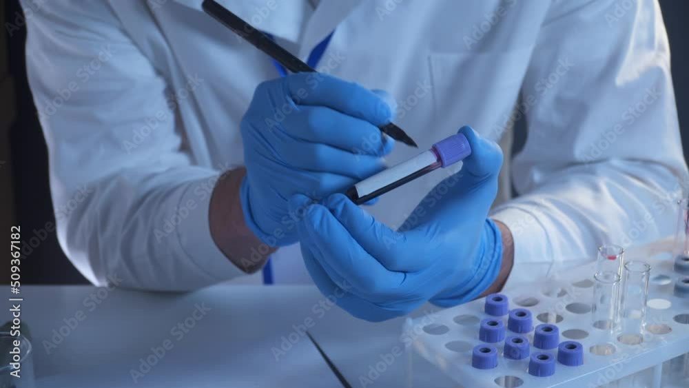 Lab technician does tests and analyses. Marker-signs thin tubes with ...