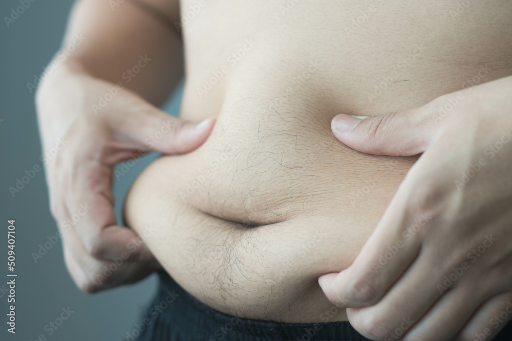 belly of a obesity man belly of a obesity man