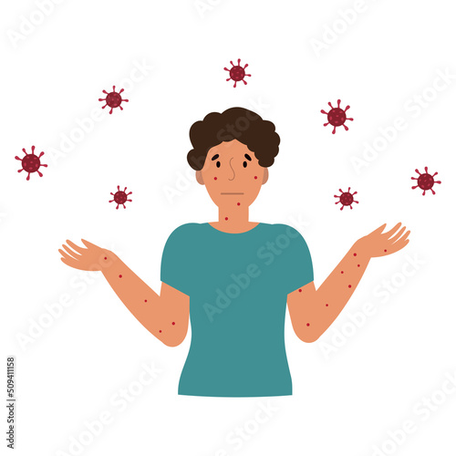 Flat vector illustration of man in t-shirt with blisters on skin caused by ingestion of monkeypox virus isolated on white background
