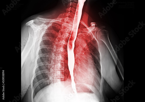 Esophagram.