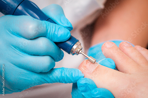 A pedicure master polishes the toenails with a mechanical device with an abrasive nozzle. Close-up. The concept of a professional nail care salon